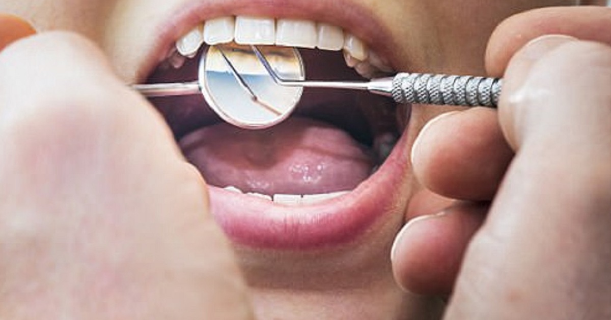 Dùng thuốc tê vứt bỏ để nhổ 13 chiếc răng cho bệnh nhân