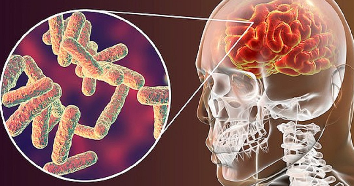 Ăn thức ăn thừa của bạn cùng phòng, chàng trai bị nhiễm trùng phải cắt cụt chi