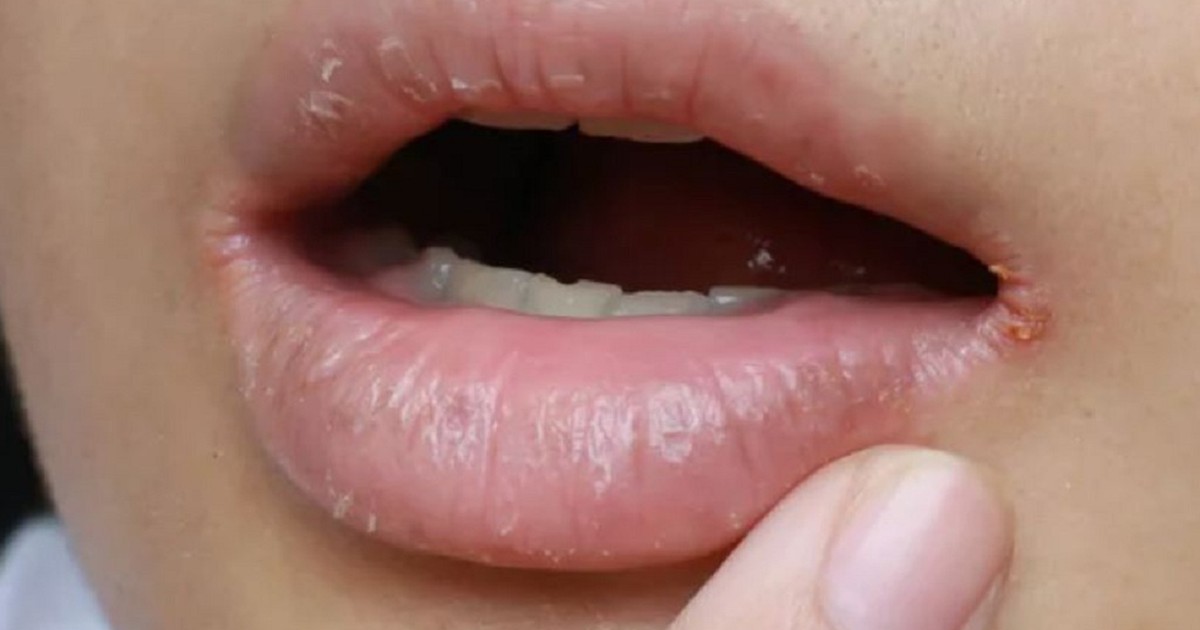 Mô tả SEO giàu ngữ nghĩa
