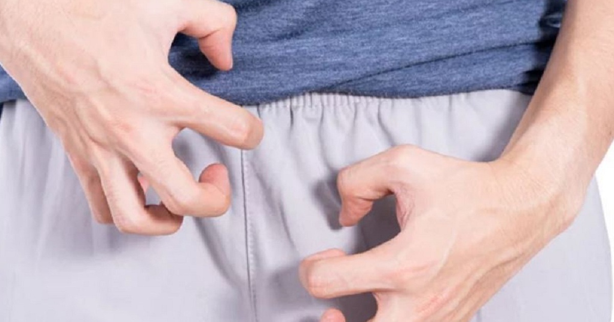 Nghiên cứu mới phát hiện bệnh đậu mùa khỉ gây sưng dương vật