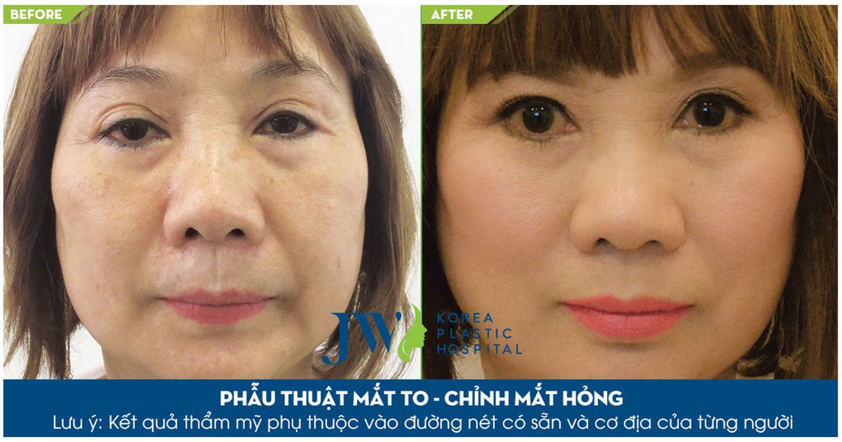 JW vinh dự chào đón Chủ tịch Hiệp hội Thẩm mỹ Mắt Hàn Quốc đến Việt Nam