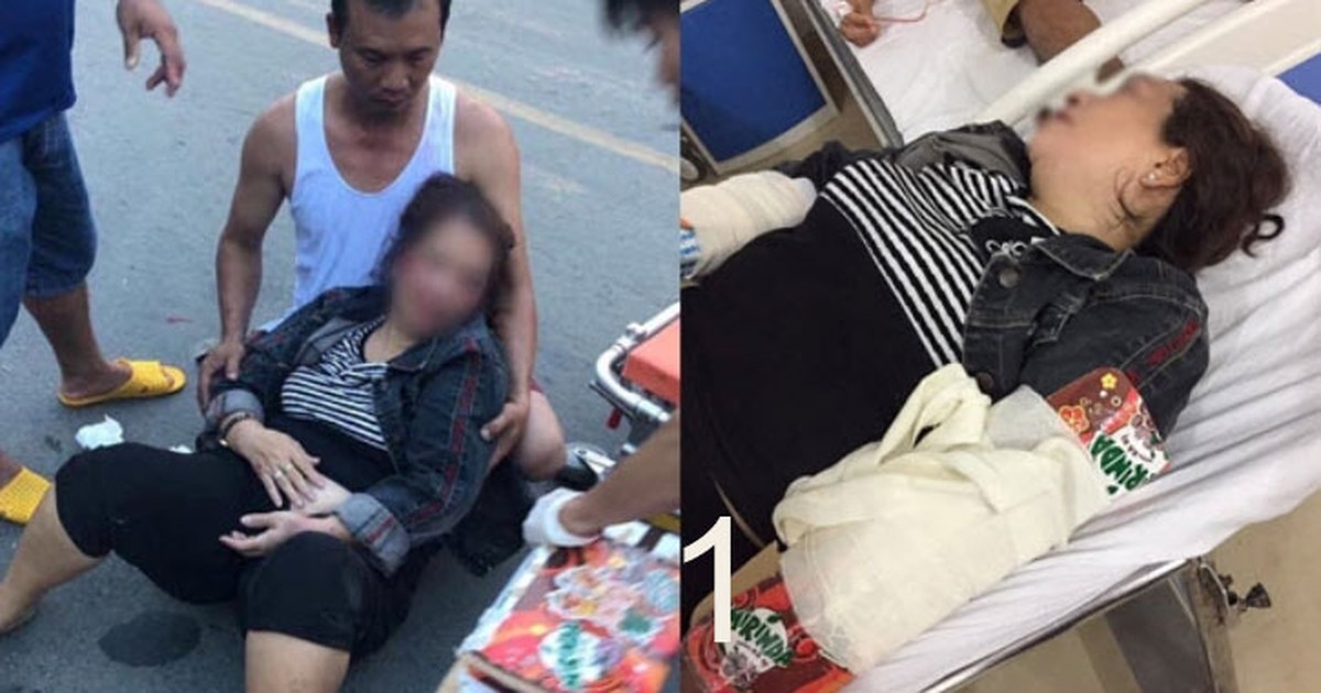 Nóng trên mạng xã hội: Bức xúc vì chó thả rông gây chết người