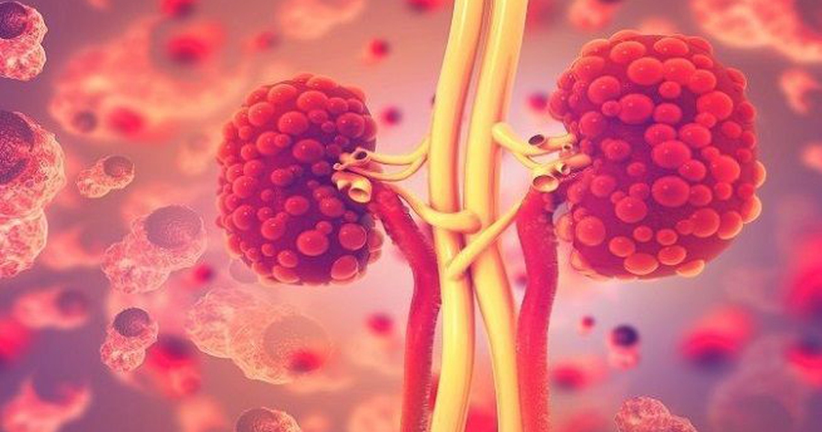 Những điều cần lưu ý để phòng bệnh thận