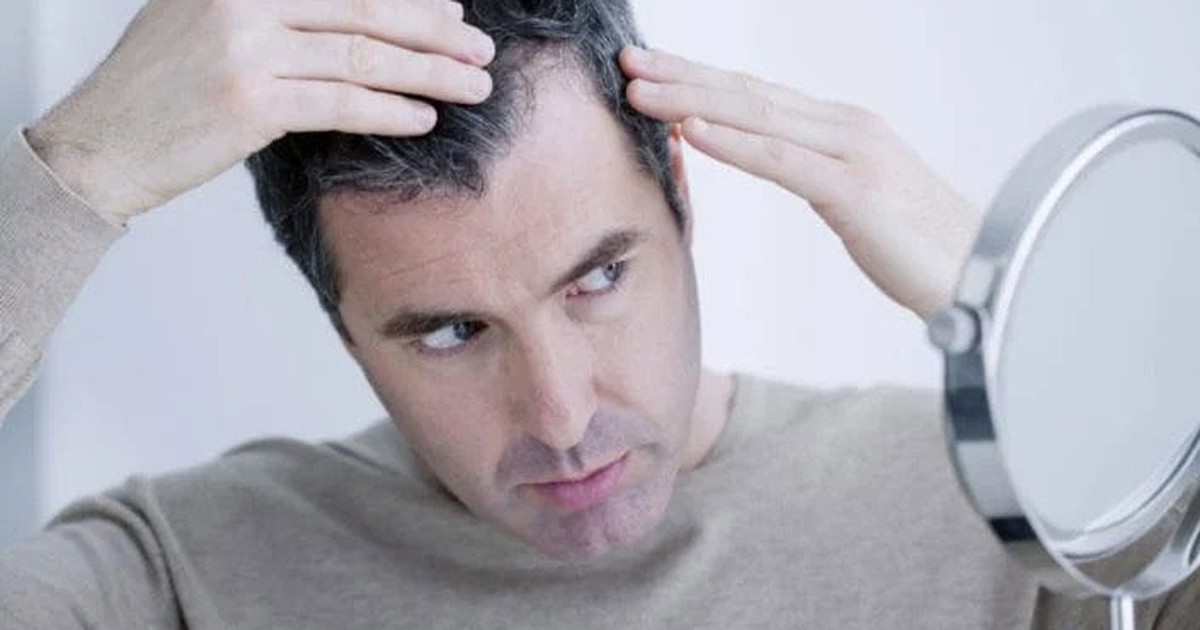 Bị rụng tóc hậu Covid-19: Khi nào thì khỏi?