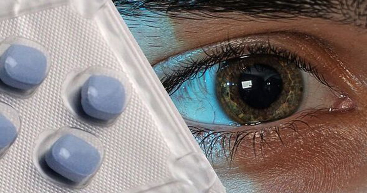 Nghiên cứu phát hiện lạm dụng Viagra có thể ảnh hưởng đến mắt