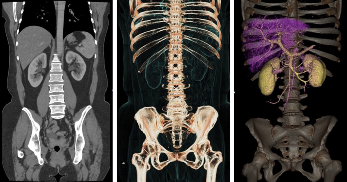 Trí tuệ nhân tạo NVIDIA tăng tốc xử lý trong lĩnh vực y tế