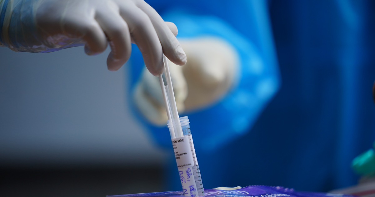 TP.HCM: Phát hiện 419 ca mắc Covid-19 trong ngày 2.7