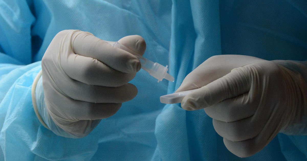 4 tình huống xác định ca mắc Covid-19