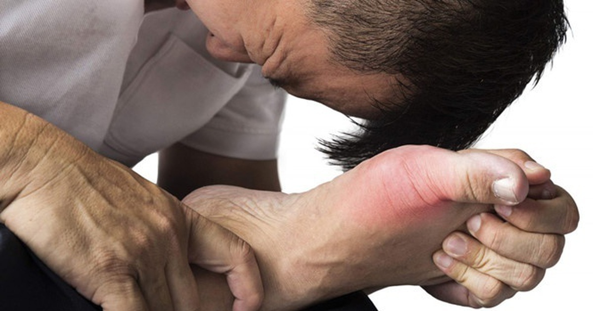 Khuyến cáo về độc tính của thuốc Colchicin điều trị bệnh gout