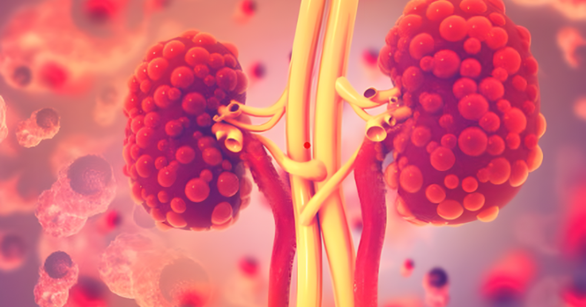 Chuyên gia chia sẻ những dấu hiệu cho thấy thận yếu