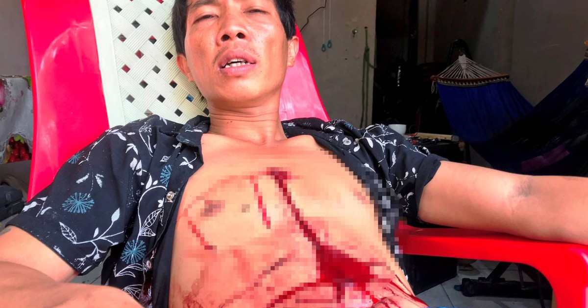 Thanh niên bị bắn vào ngực nhưng 'thà chết không đi bệnh viện'