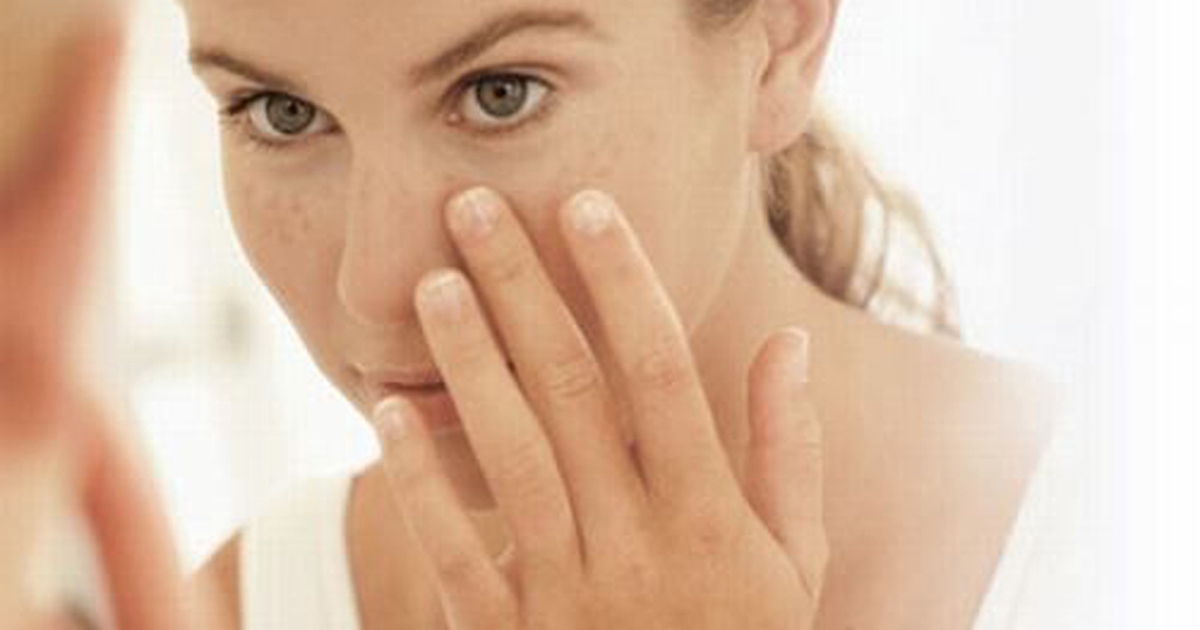 Sản phẩm hỗ trợ trị nám da nào được tin dùng hiện nay?