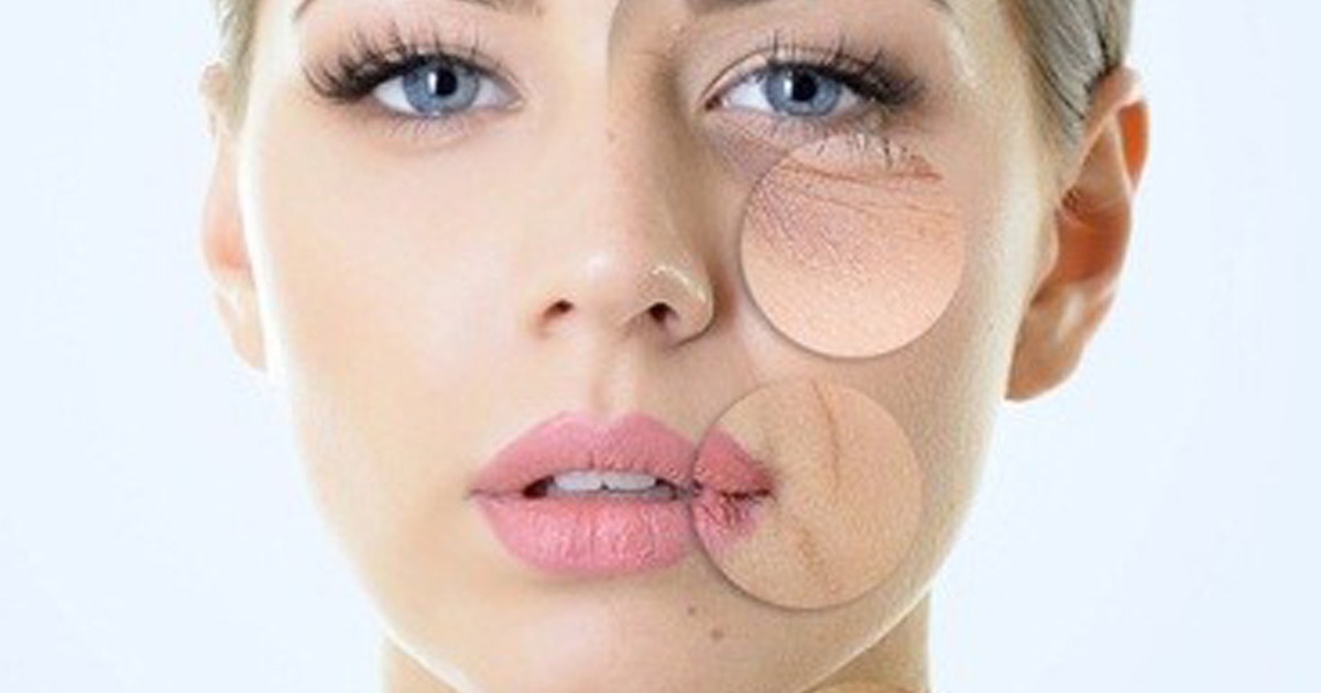 Làm sao để hạn chế hiệu quả tình trạng da nhăn nheo ở tuổi 40?