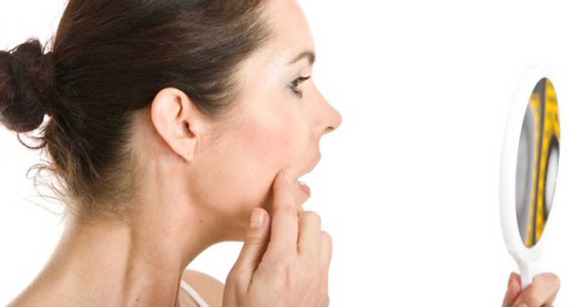 Phải làm gì khi kem chống nắng là tác nhân số 1 gây mụn trên da?