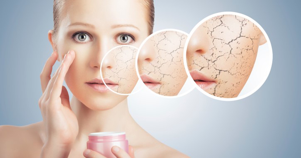 5 bí kíp dưỡng mềm mịn hoàn hảo cho da khô