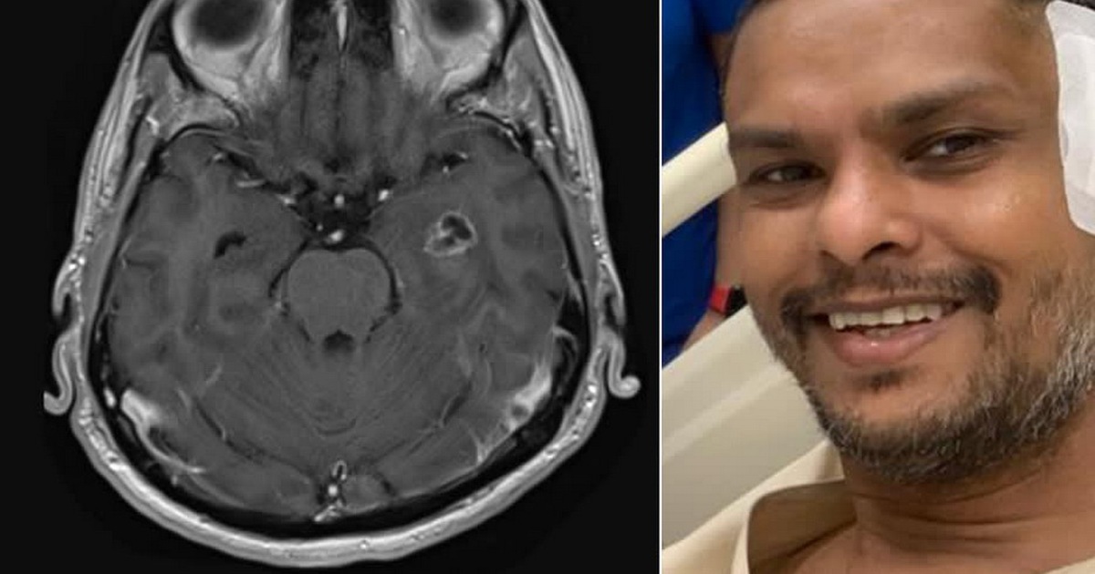 Bất ngờ có thói vũ phu, thủ phạm là khối u não và cái kết lạ