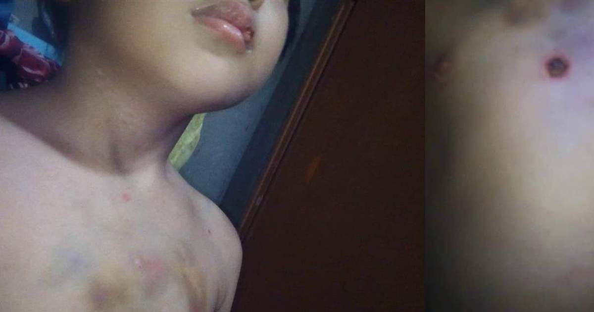 TP.HCM: Bắt khẩn cấp người đàn ông bạo hành con riêng của vợ hờ