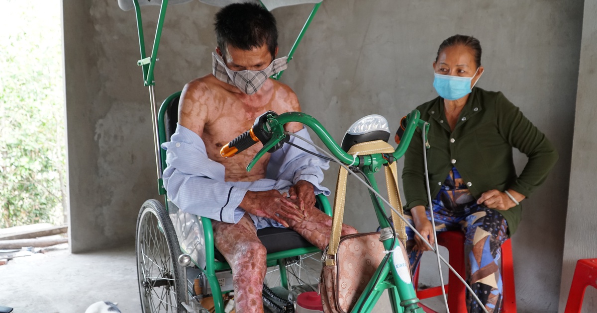 Người mẹ nghèo miền Tây chấp nhận 4 lần lóc da cứu con trai bỏng cả cơ thể