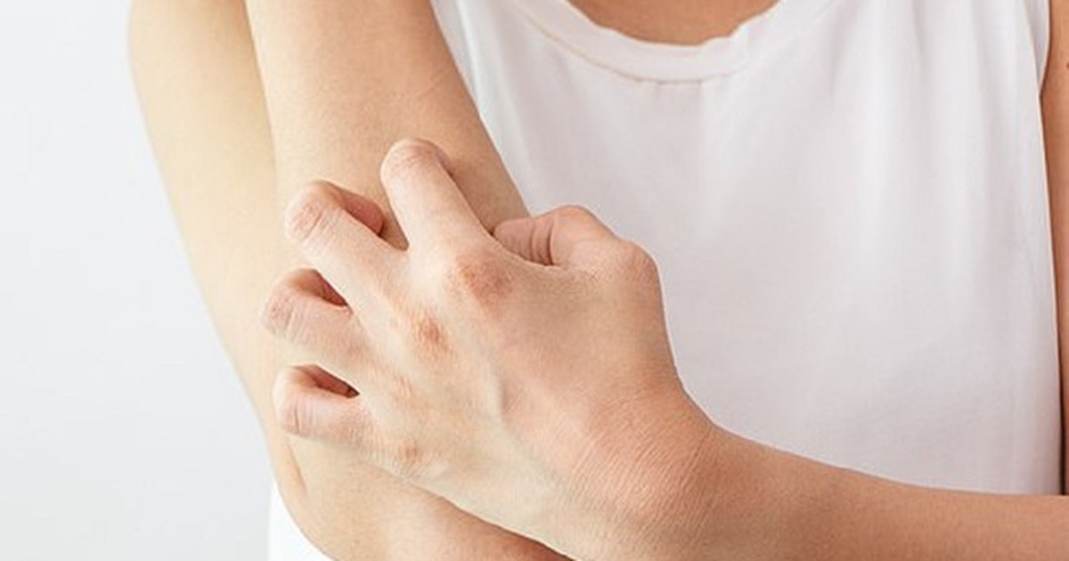 Bác sĩ ơi: Xử trí như thế nào khi bị dị ứng thuốc?