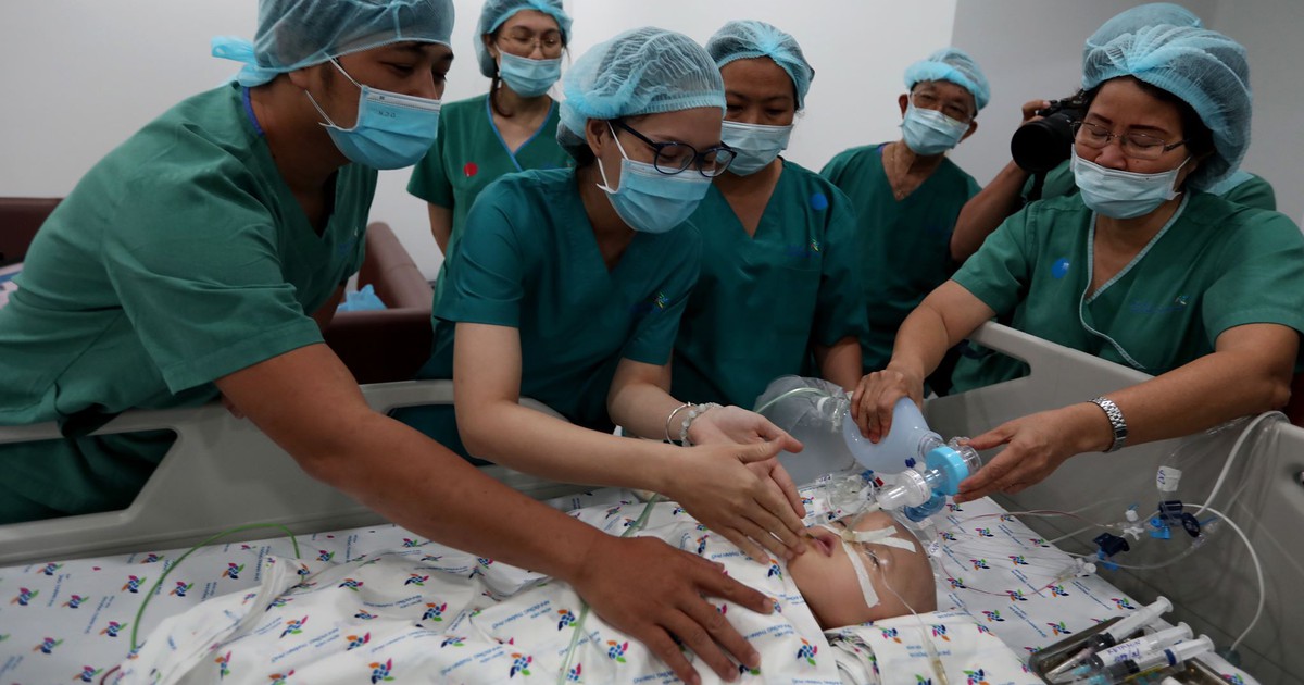Tách cặp song sinh dính nhau: Sẽ tiếp tục mổ tái tạo đường tiêu hóa, tiết niệu