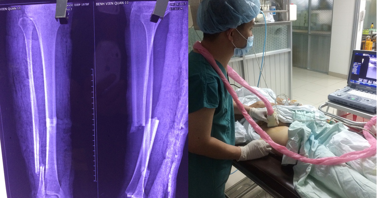 Bệnh viện quận ghép xương thành công cho bệnh nhân bệnh tim phức tạp