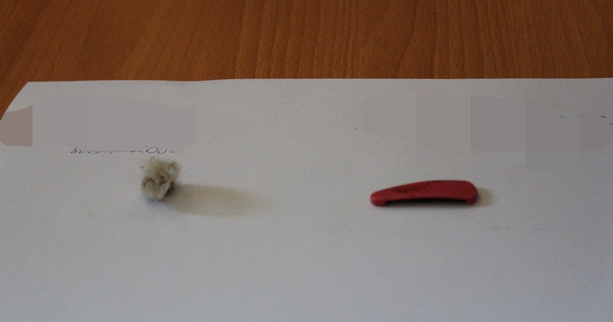 Tưởng bị hành kinh nào ngờ bé gái nhét dị vật vào 'vùng kín'