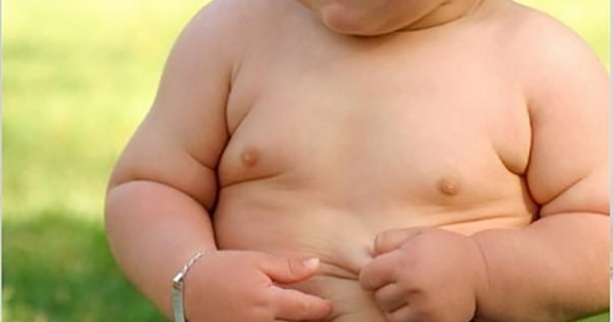 Thừa cân nhưng bé trai 6 tháng tuổi vẫn thiếu máu, thiếu sắt nặng