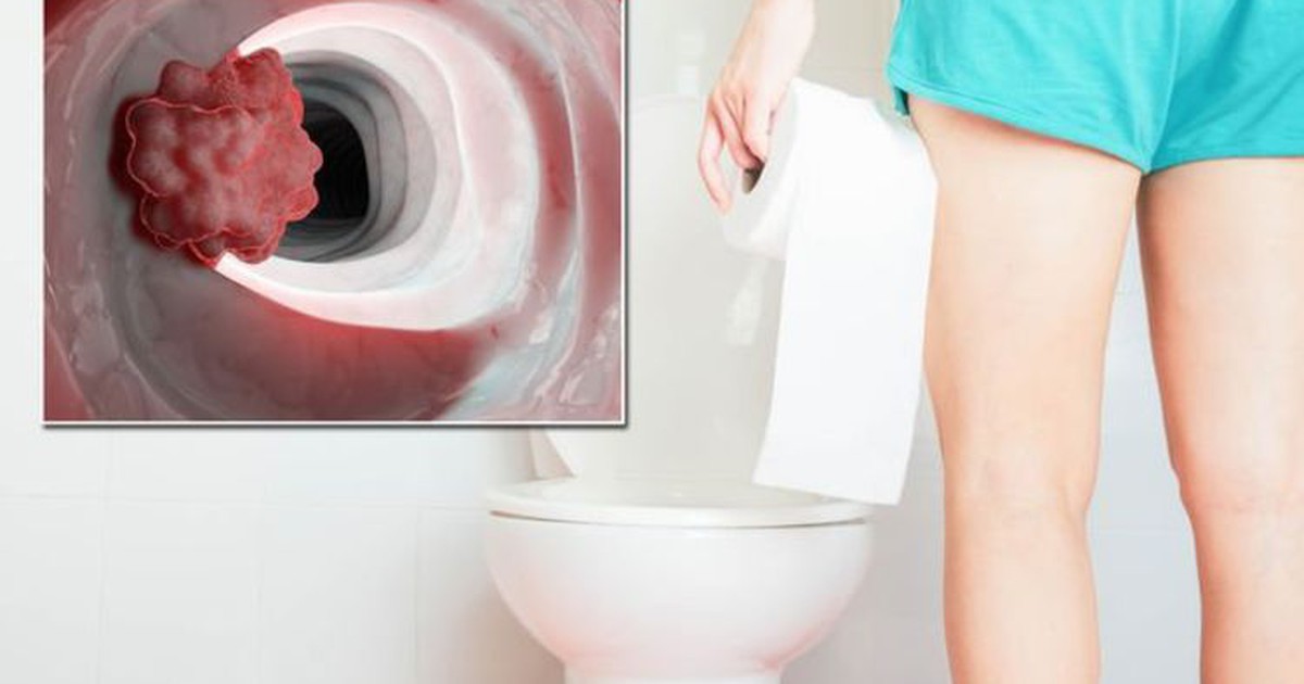 Nhìn thấy phân có hình dạng này, mau đi khám ung thư ruột
