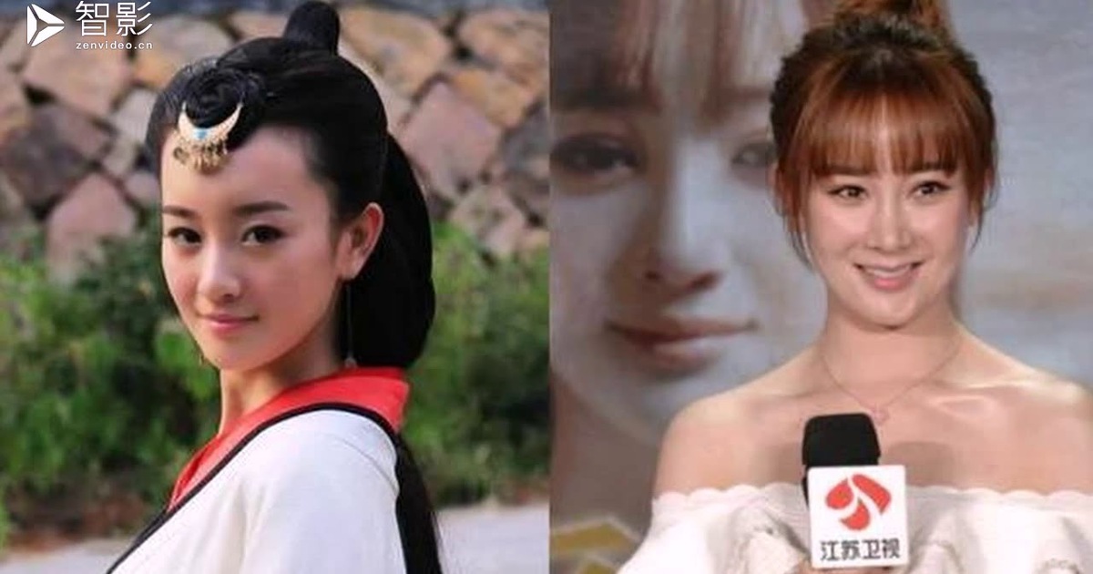 Mỹ nhân 'Tân Thiên long bát bộ' trở thành thảm họa phẫu thuật thẩm mỹ