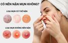 Có nên nặn mụn? Chia sẻ từ chuyên gia khiến nhiều người tiếc vì không biết sớm