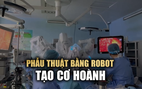 Bệnh viện Bình Dân lần đầu tiên sử dụng robot phẫu thuật ứng dụng trong tạo hình cơ hoành