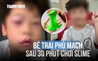 Bé trai 5 tuổi phù mạch sau 30 phút chơi 'chất nhờn ma quái' slime