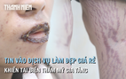 Bệnh viện Da Liễu cảnh báo tai biến thẩm mỹ gia tăng từ dịch vụ làm đẹp, giá rẻ