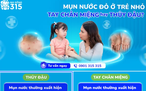 Làm sao phân biệt mụn nước và thủy đậu?
