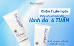 Review kem mờ sẹo thâm mụn Scar Esthetique tốt không mà luôn lọt top đầu bán chạy?