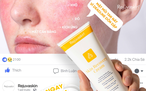 Hệ lụy từ trào lưu treatment ‘thần tốc’: Khi đẹp nhanh chưa chắc là da khỏe