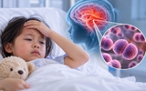 Não mô cầu nhóm B nguy hiểm thế nào, phòng bệnh ra sao?