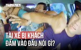 Tài xế bị đấm vào đầu vì lái xe chậm: 'Tôi từng chấn thương sọ não'