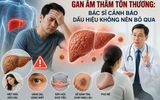 Gan âm thầm tổn thương: Bác sĩ cảnh báo dấu hiệu không nên bỏ qua