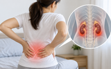 Đau lưng: Phân biệt đau do thận với đau thông thường
