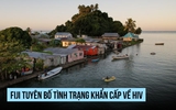 Số ca nhiễm HIV tăng vọt, Fiji tuyên bố tình trạng khẩn cấp