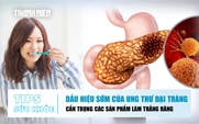 Bản tin sức khỏe 2.9: Dấu hiệu của ung thư đại tràng | Cẩn trọng sản phẩm làm trắng răng