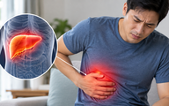 3 dấu hiệu cảnh báo gan nhiễm mỡ đang tiến triển