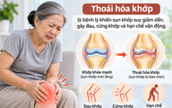 Huyết áp cao: Phát hiện tác hại không ngờ