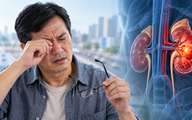 Dấu hiệu lạ ở mắt giúp người đàn ông phát hiện ung thư thận giai đoạn 4