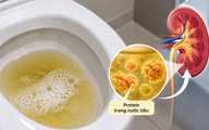 Thận yếu: Bác sĩ dặn đừng bỏ qua dấu hiệu đầu tiên này