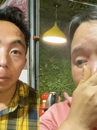 Vụ 4,2 triệu/cuốc xe: 'Tôi sợ không đủ tiền, tài xế không cho xuống xe'