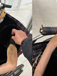 Công an điều tra vụ nữ giúp việc bạo hành cụ bà 82 tuổi ở Hà Nội