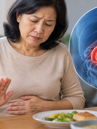 4 dấu hiệu ung thư dạ dày dễ bị nhầm với rối loạn tiêu hóa