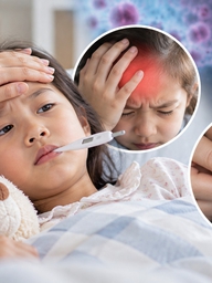 Não mô cầu: Khi nào cần cảnh giác với sốt, đau đầu, phát ban?